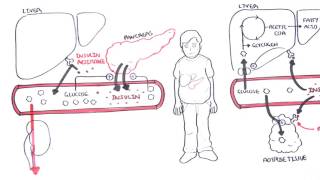 Diabetes Type II Pathophysiology [upl. by Perl609]