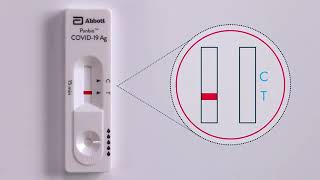 Panbio™ COVID 19 Ag Nasal Swab Procedure Live Action [upl. by Acimat]