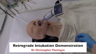 Retrograde Intubation Demonstration [upl. by Wivina]