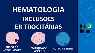 Inclusões nos Eritrócitos  Hematologia [upl. by Ridinger]