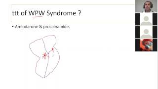 37 CVS pharma anti arrhythmics USMLE ENDPOINT [upl. by Coyle698]