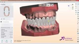 How to design Digital Full Dentures in 3Shape [upl. by Hazelton756]