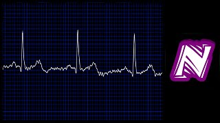 Sonido de monitor cardiaco  Heart monitor sound effect  Ekg sound  Sonido electrocardiograma [upl. by Annitsirhc]