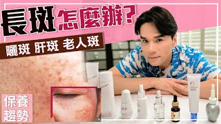 超強淡斑攻略，雀斑、曬斑、孕斑、老人斑一次搞懂！ll Kevin想得美 ll How To Remove Dark Spots On Face [upl. by Glover]