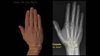 Anatomy of Hand XraysRevised [upl. by Tufts246]