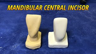 Carving of Mandibular Central Incisor Tooth Morphology [upl. by Direj]