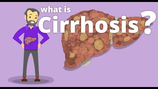 Cirrhosis  What is cirrhosis [upl. by Burwell]