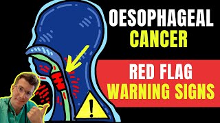 Warning signs amp symptoms of OESOPHAGEALAKA esophageal gullet CANCER  Doctor ODonovan explains [upl. by Oirogerg]