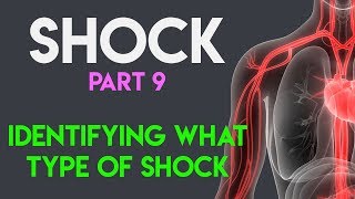 Identifying What Type Shock  Shock Part 9 [upl. by Elleb]