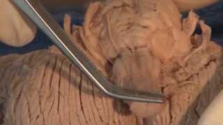 Cranial Nerves Neuroanatomy Video Lab  Brain Dissections [upl. by Ellekim471]