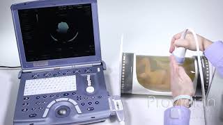 4D Ultrasound Tutorial Understanding 4D Imaging [upl. by Julia282]