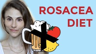 ROSACEA DIET FOODS SUPPLEMENTS PROBIOTICS DR DRAY [upl. by Suoicerp576]