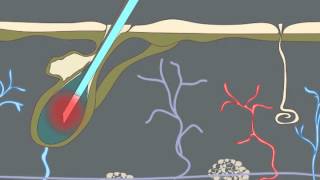 How Electrolysis Works Animation [upl. by Ahsiyn]