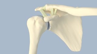 Meniscus Allograft Transplant  CONMED Animation [upl. by Eelam404]