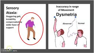 Friedreich’s ataxia Causes Symptoms Diagnosis Treatment Pathology USMLE NCLEX MCAT 3 minutes [upl. by Arak402]