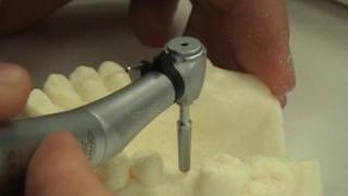 Dental implant surgery training video [upl. by Malinde21]