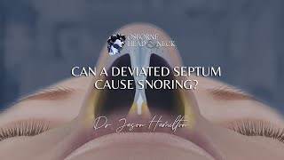 Can a deviated septum cause snoring [upl. by Bautista]