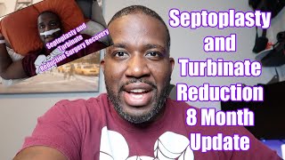 Septoplasty and Turbinate Reduction Surgery 8 Month Update  Deviated Septum Surgery [upl. by Nyrad]