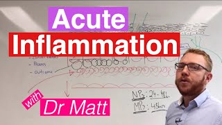 Acute Inflammation  Immunology [upl. by Innor]