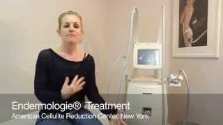 LPG Endermologie Treatment Smooth Cellulite Sculpt the Body [upl. by Anoniw]