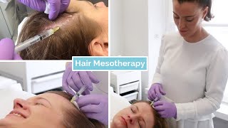 Hair Loss Mesotherapy  The Laser and Skin Clinic [upl. by Lundquist]