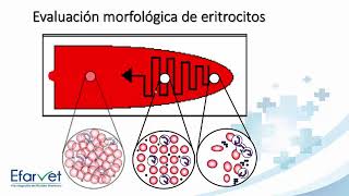 Eritrocito y alteraciones morfológicas [upl. by Llertnod]