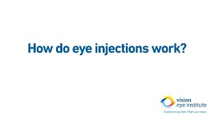 How do eye injections intravitreal injections work [upl. by Aihsakal]