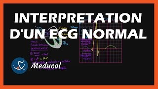 Electrocardiogramme ECG  interpretation dun ECG normal [upl. by Nylrac917]