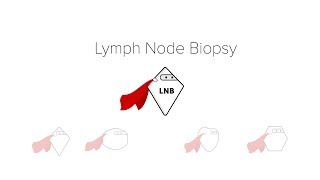 Lymph Node Biopsy [upl. by Barry436]