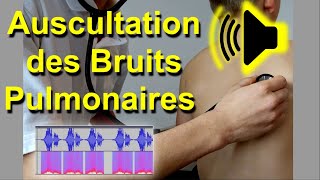 Bruits pulmonaires anormaux Auscultation Son Audio Poumon murmure vésiculaire frottement pleural [upl. by Norry]