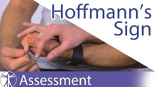 Hoffmanns Sign or Reflex  Upper Motor Neuron Lesion [upl. by Acilegna]