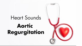 Aortic Regurgitation  Heart Sounds  MEDZCOOL [upl. by Ricker]