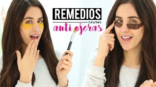 8 Remedios caseros para las ojeras  Anti ojeras perfecto [upl. by Ycnaf399]