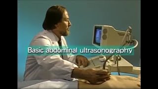 How to do abdominal ultrasound examination [upl. by Ojadnama]