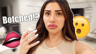 Lip Fillers Gone Wrong he roasted me [upl. by Roose]