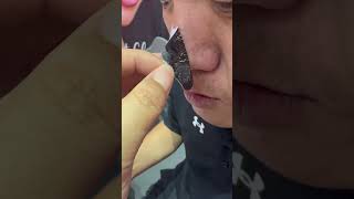 Blackheads Removal Nose Pore Strip [upl. by Lorri320]