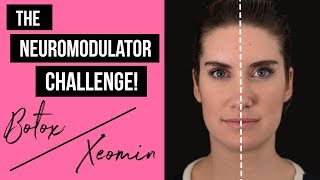 Botox vs Xeomin  The Neuromodulator Challenge [upl. by Akiret]